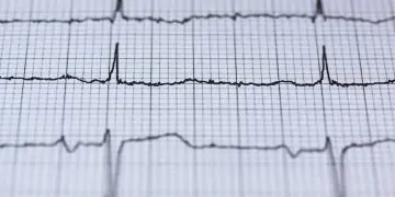 How to Test Your Heart Health From Home