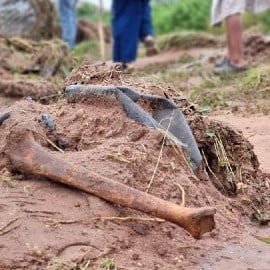 Ntuzuma Cemetery bones 02