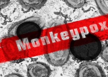 First case of Monkeypox recorded in Limpopo from a Swiss tourist